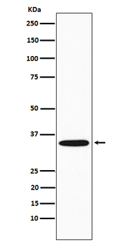 GNB2 Rabbit Monoclonal Antibody