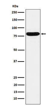 HSF1 Rabbit mAb [KD Validated] Antibody