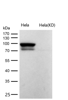 CD105 Rabbit mAb [KD Validated] Antibody