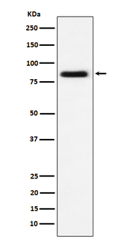 CD105 Rabbit mAb [KD Validated] Antibody