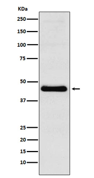 CXCR5 Rabbit mAb Antibody