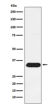 Syntenin Rabbit mAb [KD Validated] Antibody