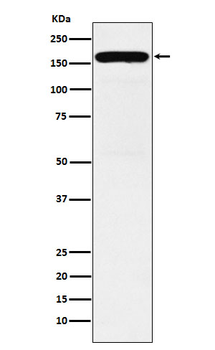 DIAPH1 Rabbit mAb [KD Validated] Antibody
