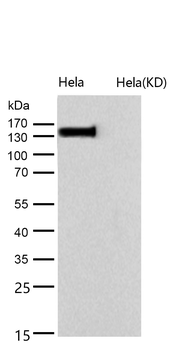 CPS1 Rabbit mAb [KD Validated] Antibody