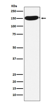 CPS1 Rabbit mAb [KD Validated] Antibody