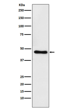 CtBP1 Rabbit mAb Antibody