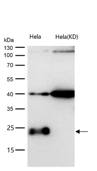 CBFb Rabbit mAb [KD Validated] Antibody