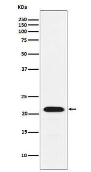 CBFb Rabbit mAb [KD Validated] Antibody