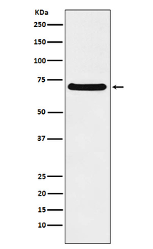 p60 CAF1 Rabbit mAb [KD Validated] Antibody