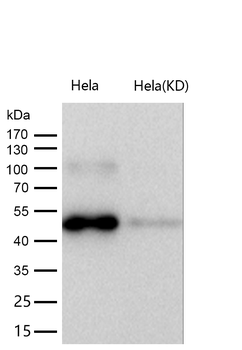 MAPKAP Kinase 2 Rabbit mAb [KD Validated] Antibody