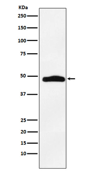 MAPKAP Kinase 2 Rabbit mAb [KD Validated] Antibody