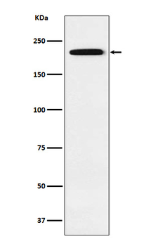 Gli3 Rabbit mAb Antibody