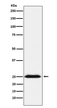BAP31 Rabbit mAb [KD Validated] Antibody