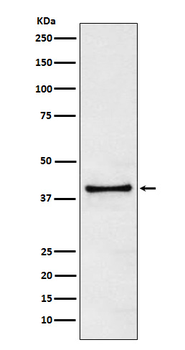 TRIB3 Rabbit mAb [KD Validated] Antibody