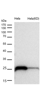 Casein Kinase 2 beta Rabbit mAb [KD Validated] Antibody
