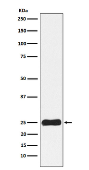 Casein Kinase 2 beta Rabbit mAb [KD Validated] Antibody