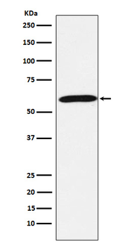 Calsequestrin 1 Rabbit mAb Antibody