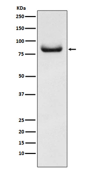APPL Rabbit mAb [KD Validated] Antibody