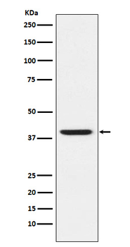 RING2/RING1B/RNF2 Rabbit Monoclonal Antibody