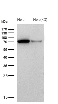 Fructose 6 Phosphate Kinase Rabbit mAb [KD Validated] Antibody