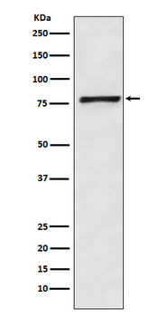 Fructose 6 Phosphate Kinase Rabbit mAb [KD Validated] Antibody