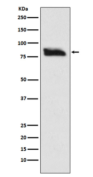 SMURF 2 Rabbit mAb Antibody