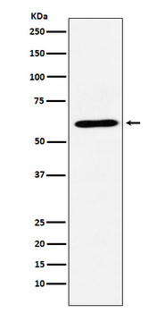 CRMP1 Rabbit mAb Antibody