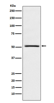 NR0B1/DAX1 Rabbit Monoclonal Antibody