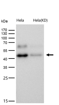 MAPKAP Kinase 2 Rabbit mAb [KD Validated] Antibody