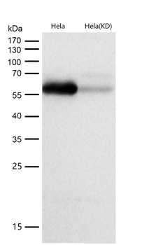 LMAN1 Rabbit mAb [KD Validated] Antibody