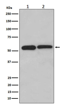 LMAN1 Rabbit mAb [KD Validated] Antibody