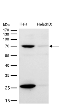 RPA70 Rabbit mAb [KD Validated] Antibody
