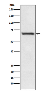 RPA70 Rabbit mAb [KD Validated] Antibody