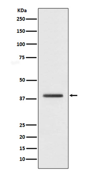 macroH2A.1 Rabbit mAb Antibody