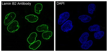 Lamin B2 Rabbit mAb [KD Validated] Antibody