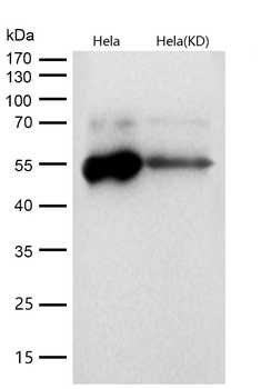 LOXL2 Rabbit mAb [KD Validated] Antibody