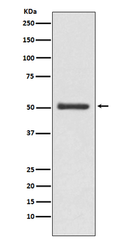 LOXL2 Rabbit mAb [KD Validated] Antibody