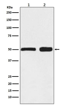 Ephrin B2 Rabbit mAb Antibody