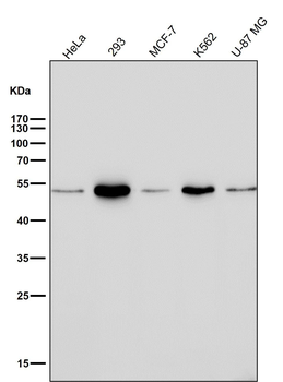 Ephrin B2 Rabbit mAb Antibody