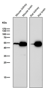Ephrin B2 Rabbit mAb Antibody