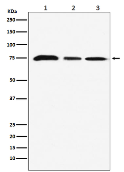 KAT7 / HBO1 / MYST2 Rabbit mAb [KD Validated] Antibody