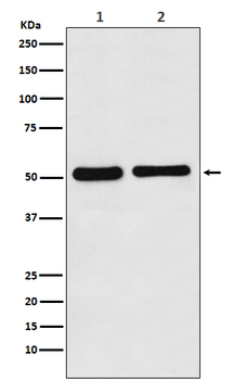 Fascin Rabbit mAb Antibody