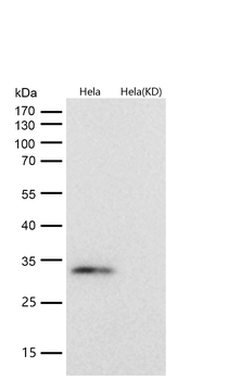 GC1q R Rabbit mAb [KD Validated]