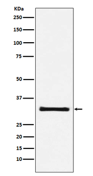GC1q R Rabbit mAb [KD Validated]