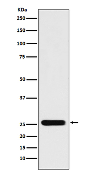 Peroxiredoxin 3 Rabbit mAb Antibody