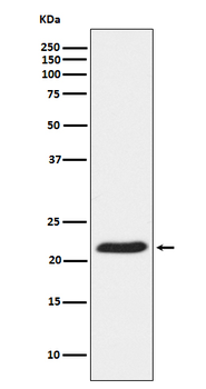 TCTP Rabbit mAb Antibody