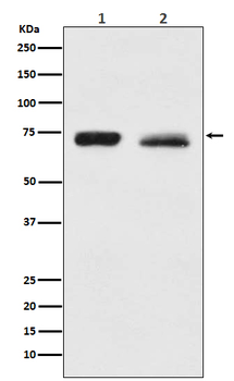 NF2 / Merlin Rabbit mAb Antibody
