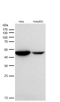 Citrate synthetase Rabbit mAb [KD Validated] Antibody