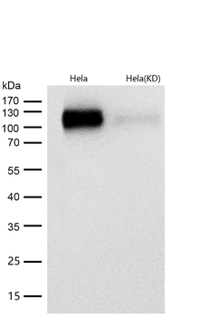 Integrin alpha V Rabbit mAb [KD Validated] Antibody