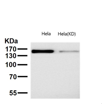 Drosha Rabbit mAb Antibody